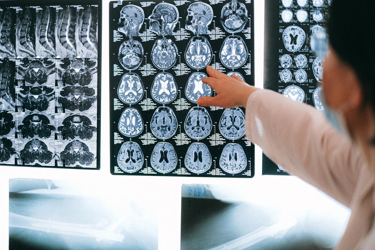 get-in-touch Radiologist pointing at brain MRI scans showing detailed medical examination.